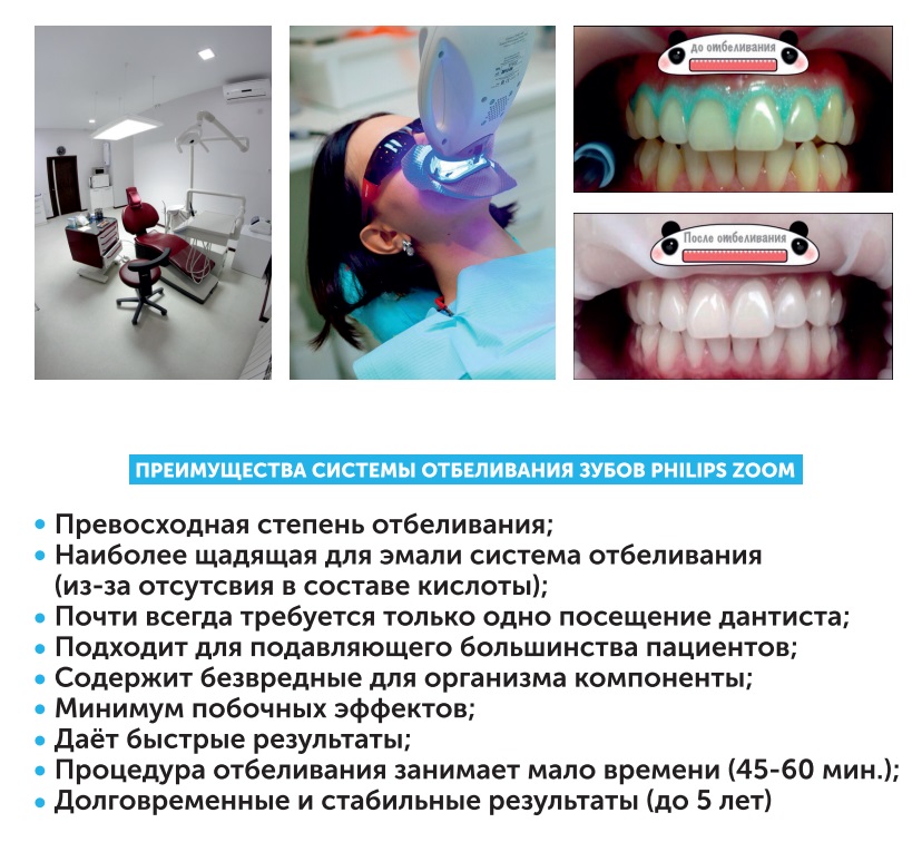 Этапы комбинированного отбеливания зубов при отбеливании зубов используют