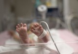 Младенца весом 1 кг прооперировали в Калуге
