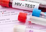 Калужане стали чаще проверяться на ВИЧ