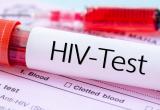 Калужане могут узнать свой ВИЧ-статус за 15 минут