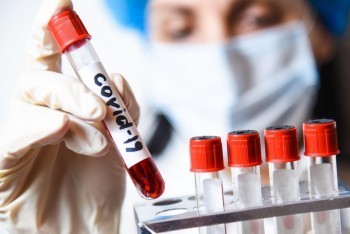 4 новых случая заражения коронавирусом выявлено в Калужской области