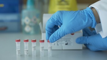 25 "семейных" очагов коронавируса выявлено в Калужской области