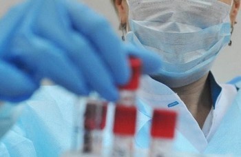 В Калужской области число подтверждённых случаев коронавируса выросло до 372