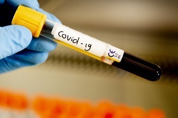 В Калужской области не зарегистрировано новых смертей от коронавируса