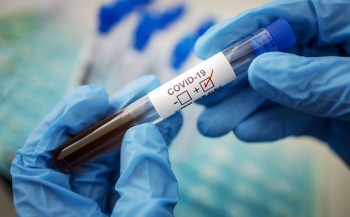 В Калужской области 69 человек справились с коронавирусом