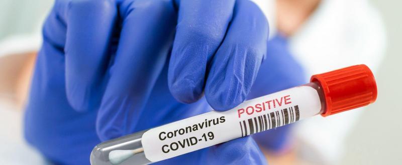 Ещё шестеро калужан скончались от коронавируса
