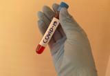 В Калужской области за сутки выявлено 79 новых случаев заражения Covid-19 В Калужской области за сутки выявлено 79 новых случаев заражения Covid-19
