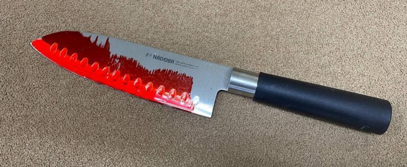 В Калуге 54-летняя женщина ударила ножом сожителя своей дочери
