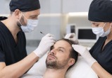 Пересадка волос в Волгограде: FUE или DHI, сколько графтов и как проходит реабилитация